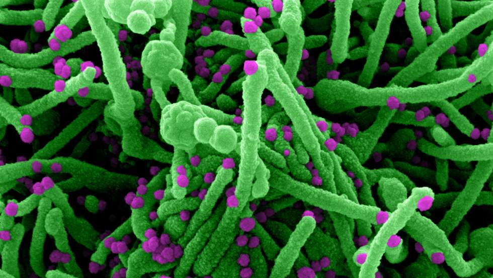 Novel coronavirus sars-cov-2