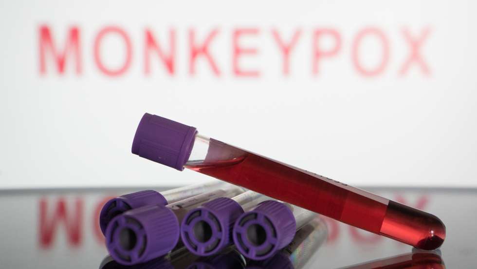 Monkeypox Photo Illustrations