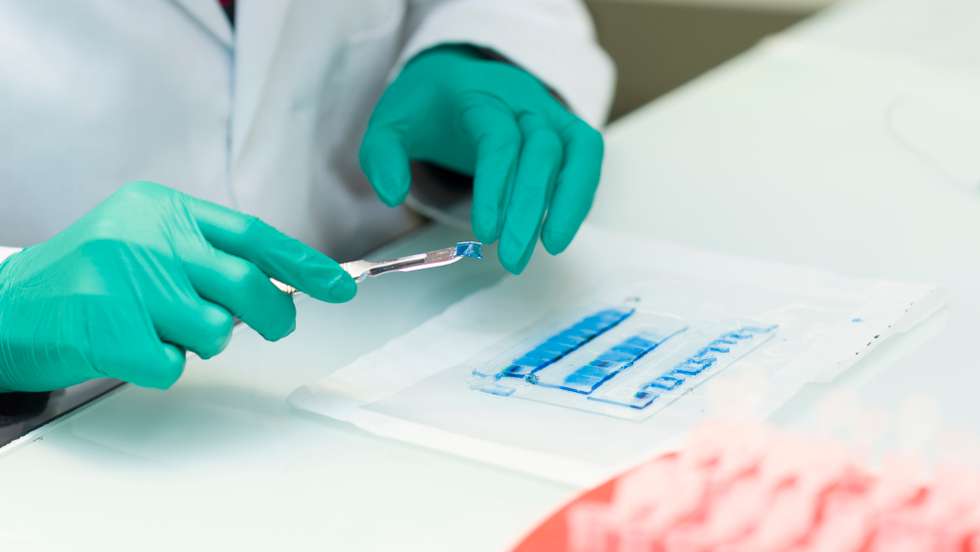 Proteomics: identification of proteins present in the samples. The electrophoresis gel bands containing proteins are recovered and placed in tubes.