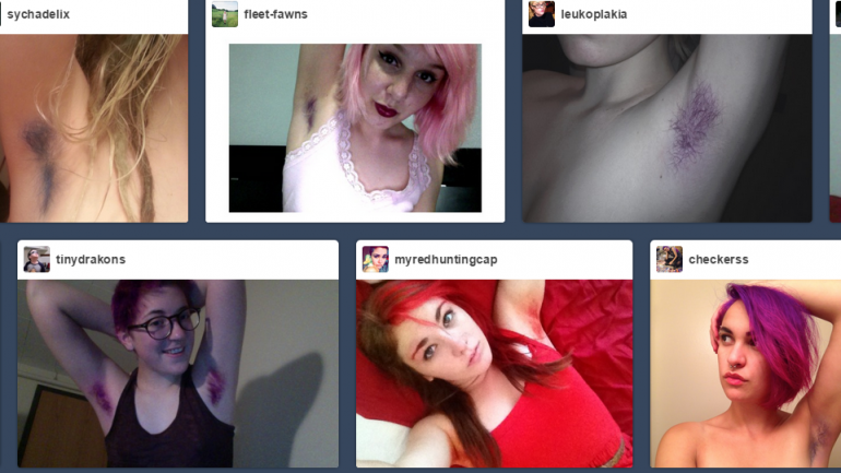 Imagem retirada do Tumblr.