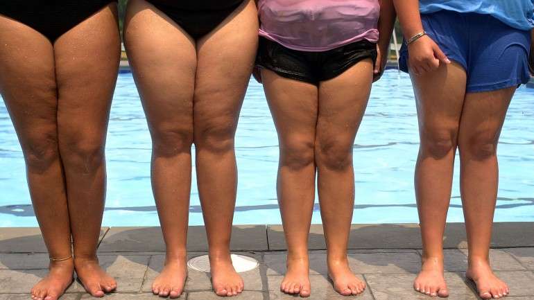 Mulheres que sofrem stress pós-traumático têm mais tendência a desenvolver problemas de obesidade