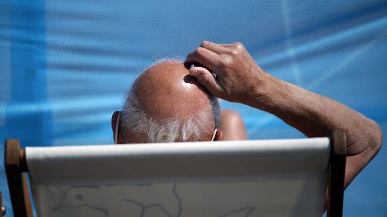 A queda de cabelo (alopécia) afeta mais de metade dos homens caucasianos em idade adulta