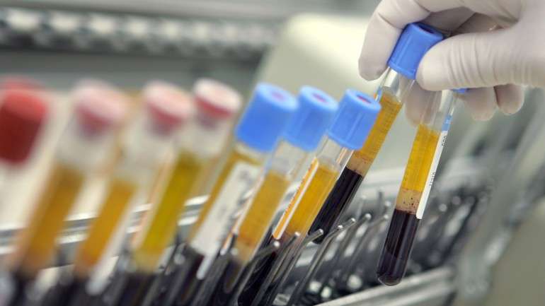 O teste pode minimizar a utilização inadequada de antibióticos