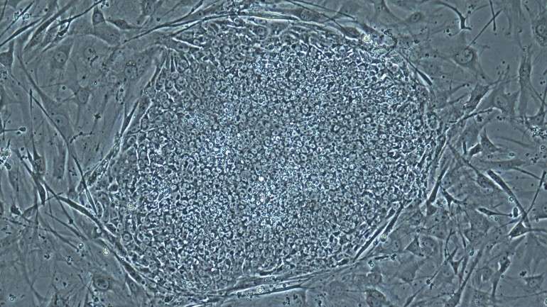 A bactéria, que pode ser encontrada em lamas e sedimentos, chama-se "Geobacter sulfurreducens"