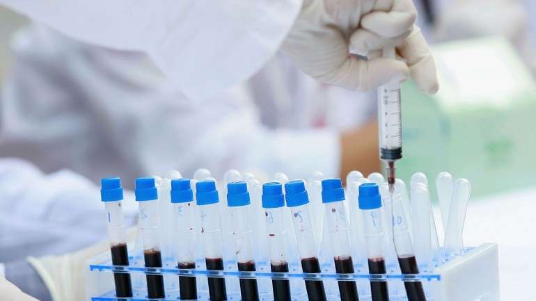 Estima-se que, no Reino Unido, 26 mil pessoas estejam infetadas sem saber