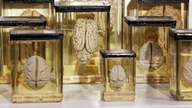 A maturidade do cérebro criado em laboratório corresponde à de um feto com cinco semanas