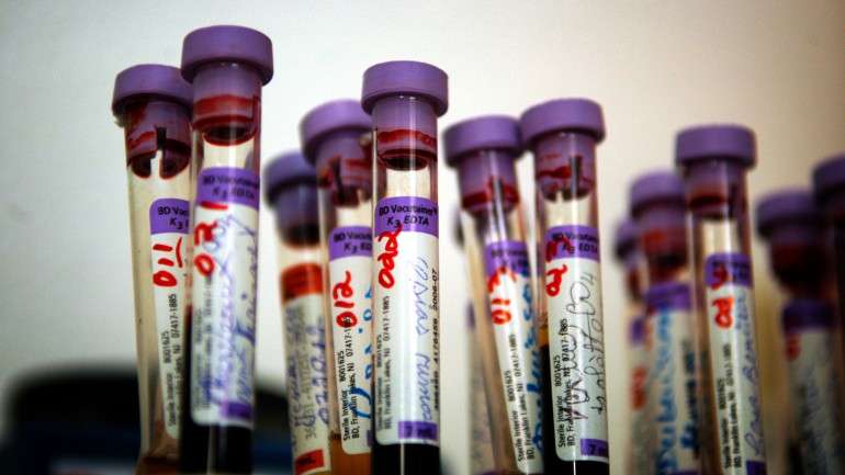 Em 2014, registaram-se 1.220 novos casos de infeção por VIH e 2.080 novos casos de tuberculose