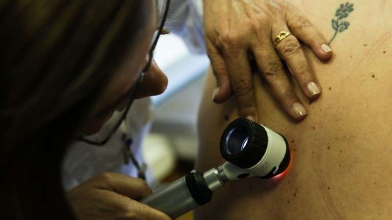 As células cancerígenas do melanoma são tão diferentes das células originais que são mais fáceis de estudar e atacar