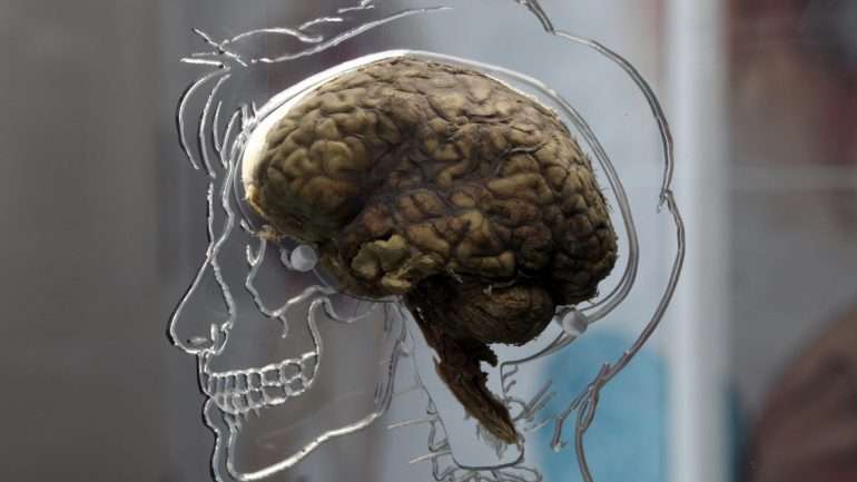 Apesar do envelhecimento mais acentuado nas pessoas mais gordas, não há diferenças ao nível da capacidade cognitiva.