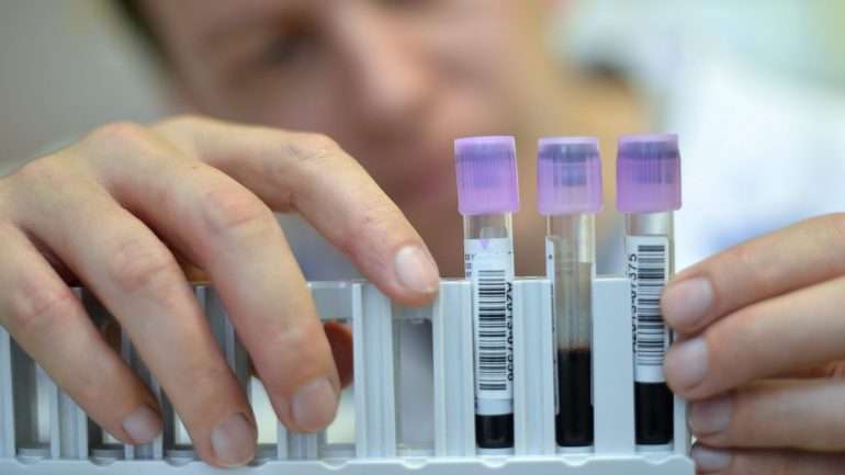 O investigador Edward Wild, da University College de Londres, afirmou que essa proteína "poderá servir como 'velocímetro' da doença de Huntington"
