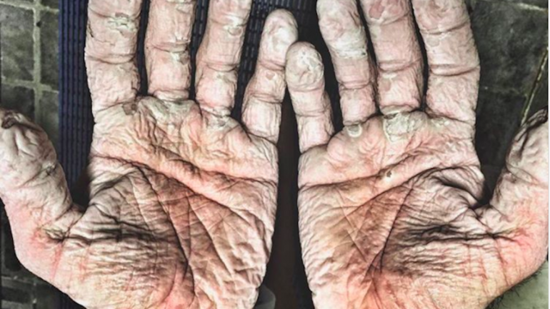Foto retirada do Instagram de Alex Gregory