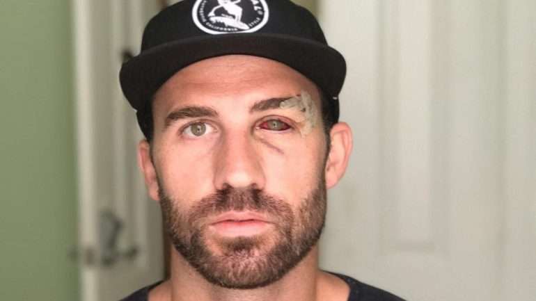 Kyle, um dos amigos de Connor McCreesh, que escreveu no site Medium o texto "Cães Raivosos em Lisboa", sobre uma cena de violência que terá acontecido este verão no Urban Beach