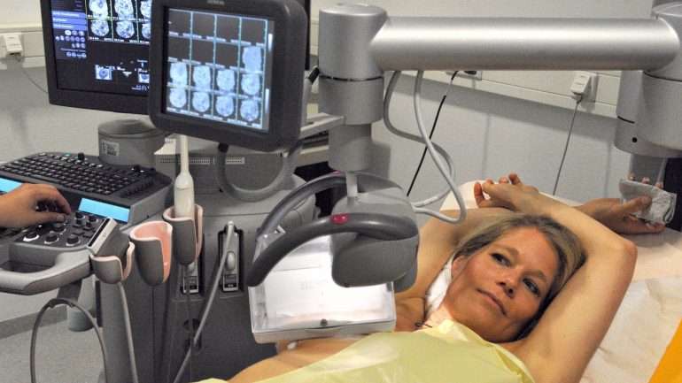 O cancro da mama provoca a morte a quatro mulheres diariamente.