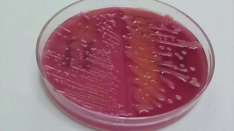 Escherichia coli (à esquerda) e a Klebsiella pneumoniae são duas bactérias que vivem no intestino, mas que se crescerem descontroladamente causam uma infeção