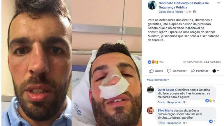 O sindicato que foi alvo de críticas do ministro por divulgar imagens de assaltantes no momento da captura decidiu agora pedir "uma reação" a Eduardo Cabrita a uma fotografia de um polícia hospitalizado