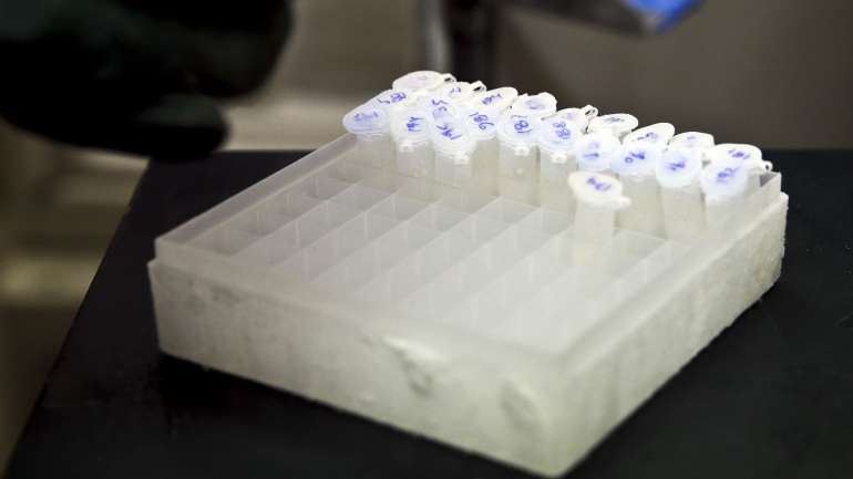 A legionella foi detetada durante os procedimentos habituais de controlo da bactéria.