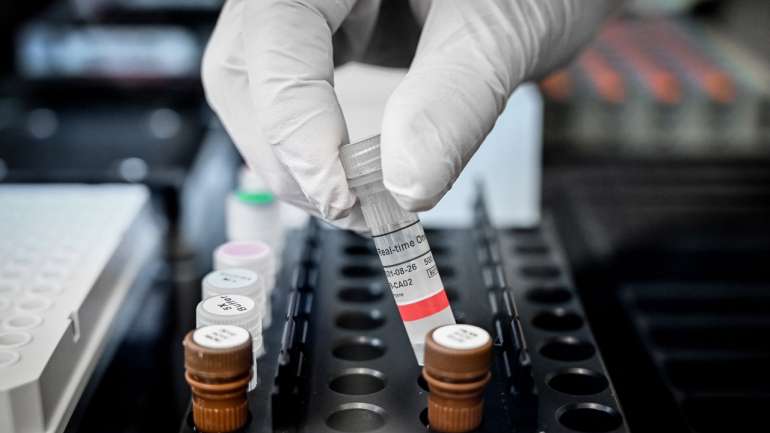 Os testes normais de diagnóstico identificam a presença do vírus; os testes serológicos aferem a imunidade