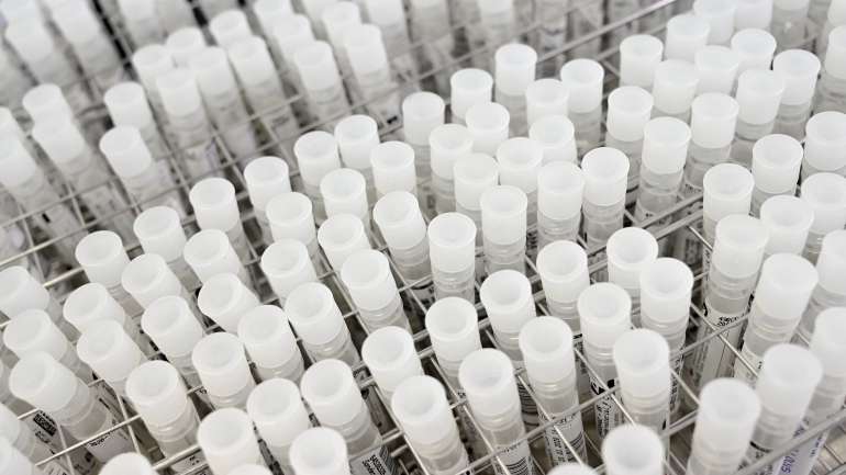 "A plataforma permite identificar possíveis mutações do vírus que possam afetar a eficiência de ligação de primers e sondas e detetar potenciais falsos positivos", informam os investigadores