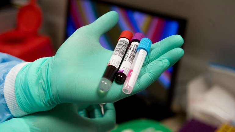 "Estou orgulhoso do pessoal do Instituto de Biotecnologia por este grande avanço. A criatividade e o pensamento judaico atingiram este grande resultado", expressou o ministro da Defesa