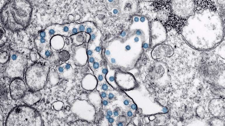 Os cientistas apontam para uma alta transmissibilidade do vírus "numa fase muito incipiente da pandemia"