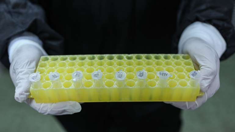 Face à pandemia da Covid-19, "é sobretudo para o diagnóstico da presença do vírus que o potencial da saliva é reconhecido de forma mais imediata", afirmou a UÉ