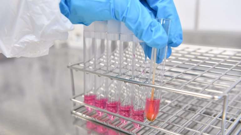 O projeto, lançado em 2019 e desenvolvido no âmbito do programa transfronteiriço INTERREG, pretende desenvolver técnicas de diagnostico e tratamento para doenças neurológicas associadas ao envelhecimento