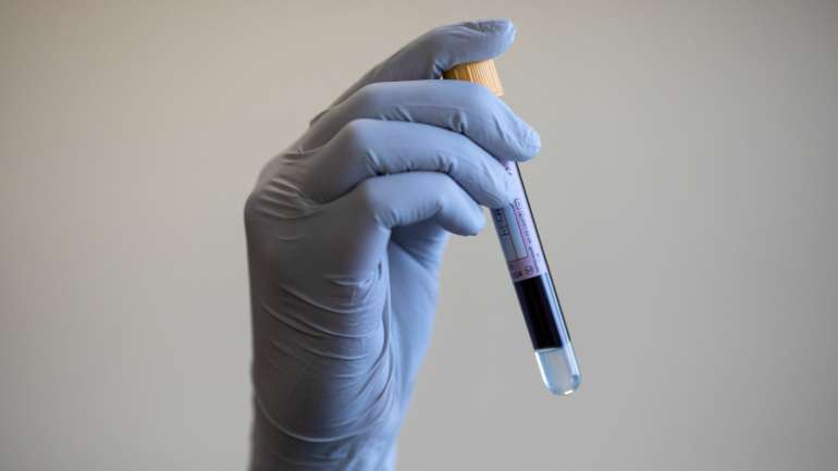 Já recuperaram da Covid-19 em Portugal 36.984 doentes