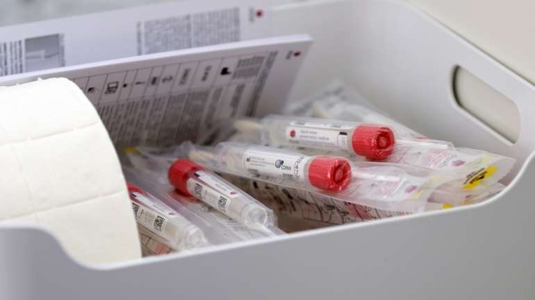 Durante a pandemia, a UEFA estabeleceu regras que dão às autoridades públicas locais poderes para gerir casos