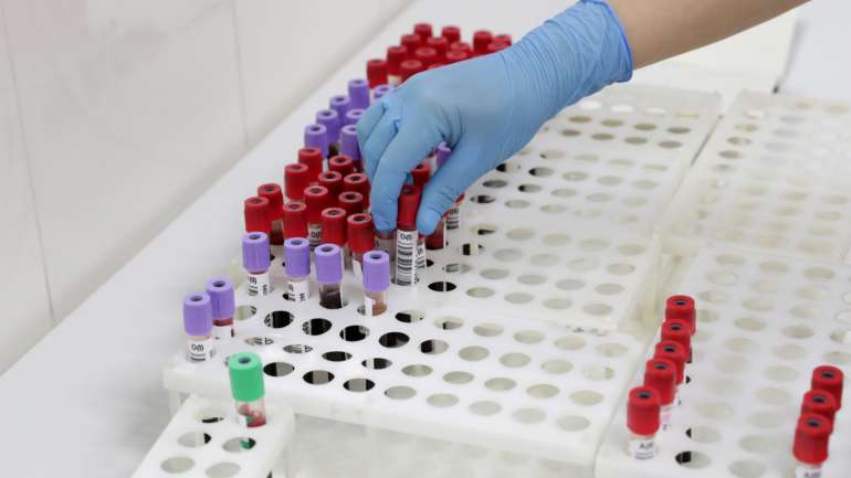 "Se tiver sangue tipo A, não precisa de começar a entrar em pânico. E se for tipo O, não é livre de ir aos pubs e bares", avisa um dos médicos responsáveis pelo estudo canadiano
