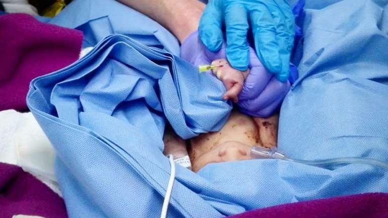 Bebé cuidado pela equipa do Inem depois de encontrado no caixote do lixo