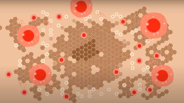 A midkina produzida pelas células cancerígenas consegue tornar as células imunitárias suas aliadas