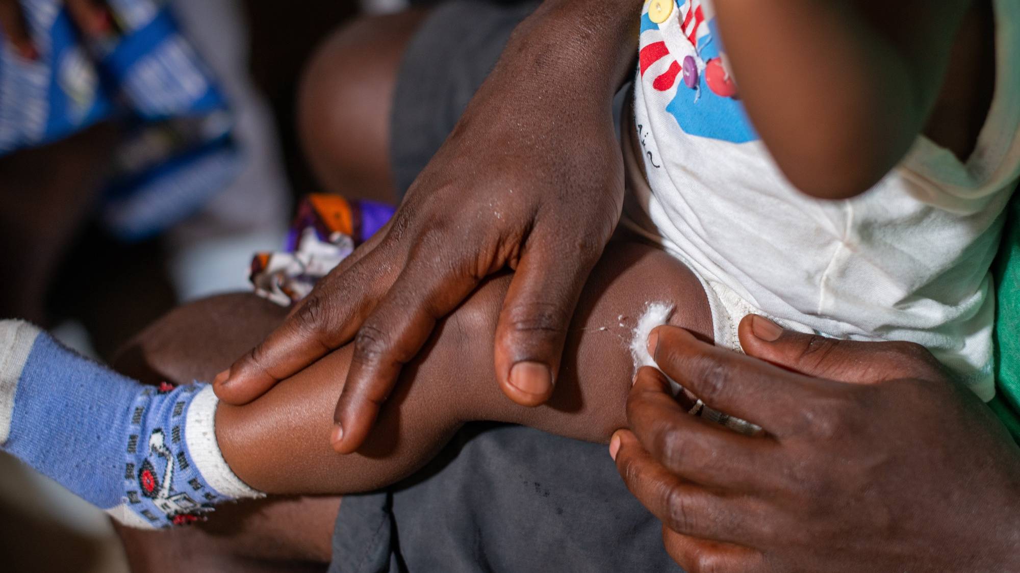 epa11096738 A mother holds her child after receiving the vaccine against malaria in Nyalla Medical Centre in Douala, Cameroon, 22 January 2024. A new malaria vaccine, known as RTS,S, or Mosquirix, made by GlaxoSmithKline, is being rolled out for the first time as an immunization campaign for children in Cameroon. According to the World Health Organisation, the WHO African Region, with an estimated 233 million cases in 2022, accounted for about 94% of cases globally. Malaria is highly endemic in Cameroon and the WHO estimates that about 11,000 people die from malaria in Cameroon every year.  EPA/DONGMO RODRIGUE WILLIAM