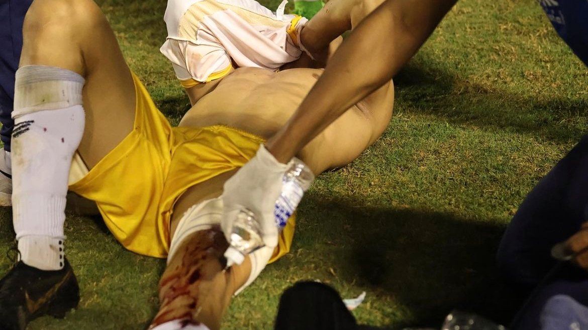 jogador de futebol atingido no joelho, no relvado, Brasil