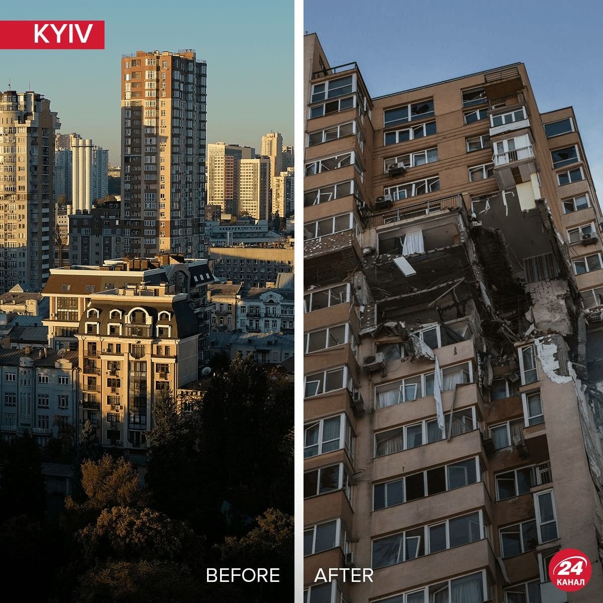 Antes e Depois Kiev