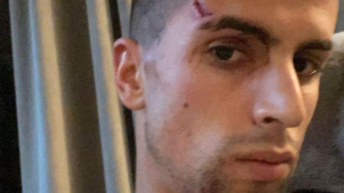 João Cancelo fez acompanhar a mensagem no Instagram com uma imagem onde mostra as marcas dos ferimentos com que ficou na cara
