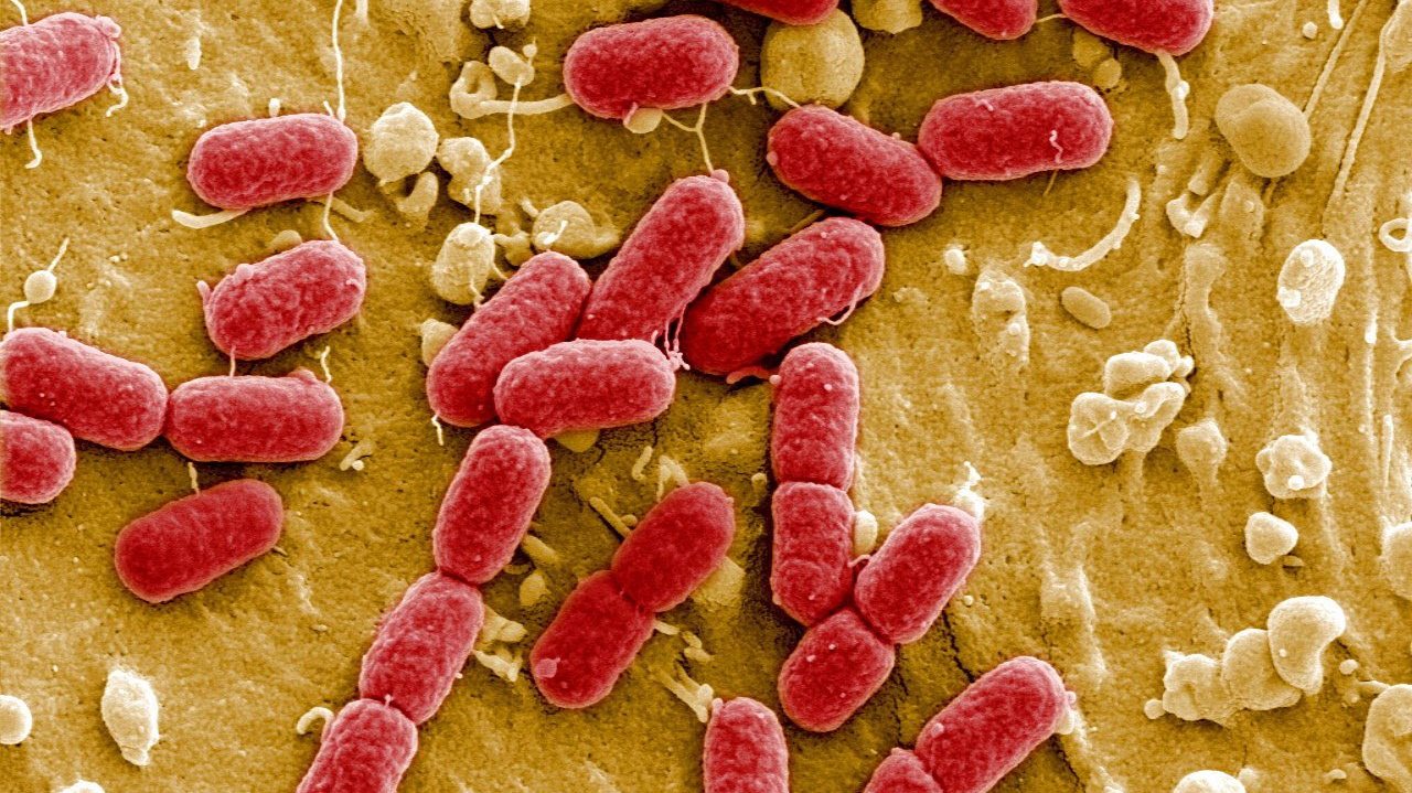 Estima-se que, em todo o mundo, as infeções causadas por estas superbactérias matem 1, 2 milhões de pessoas por ano