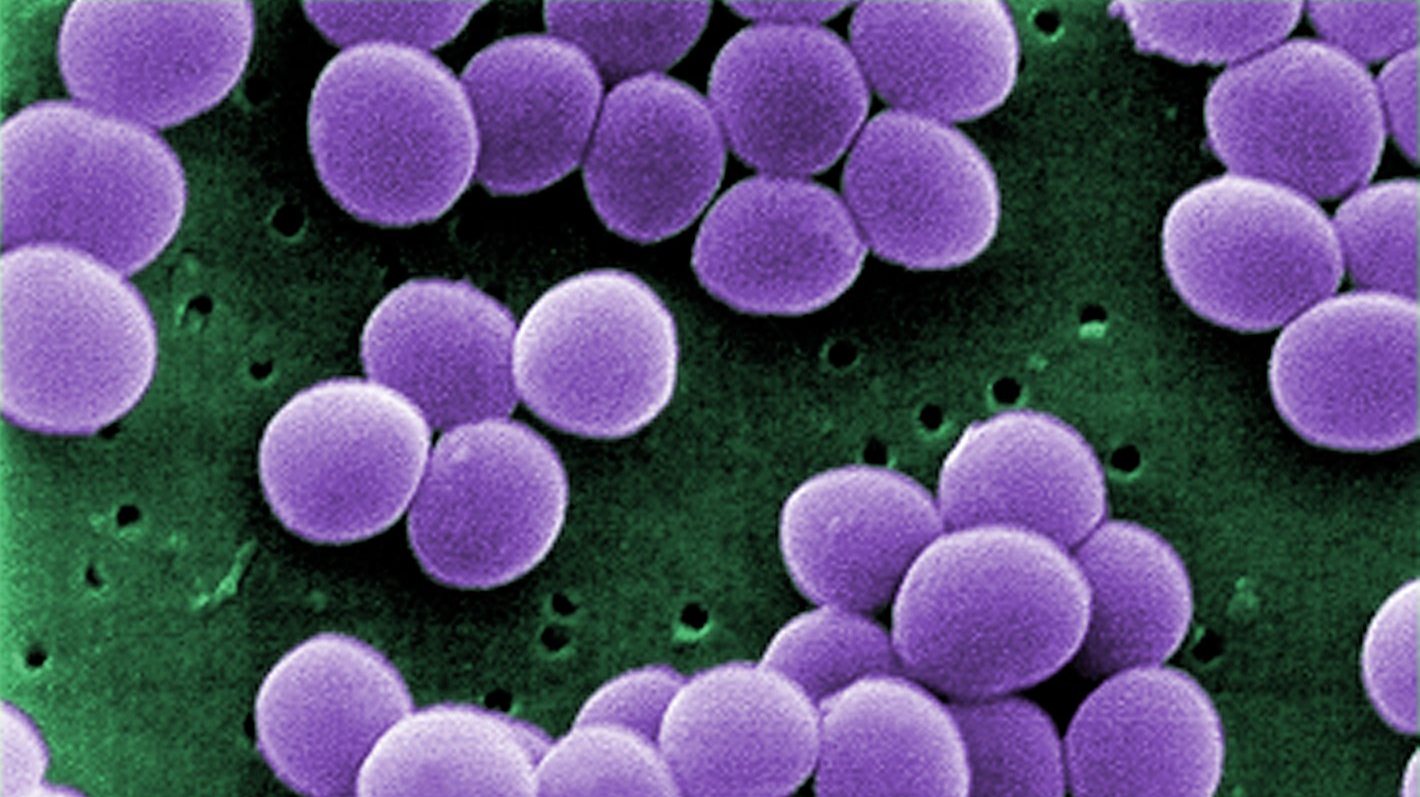 Os estafilococos — aqui, 'Staphylococcus aureus' — vivem em colónias que se assemelham a cachos de uvas