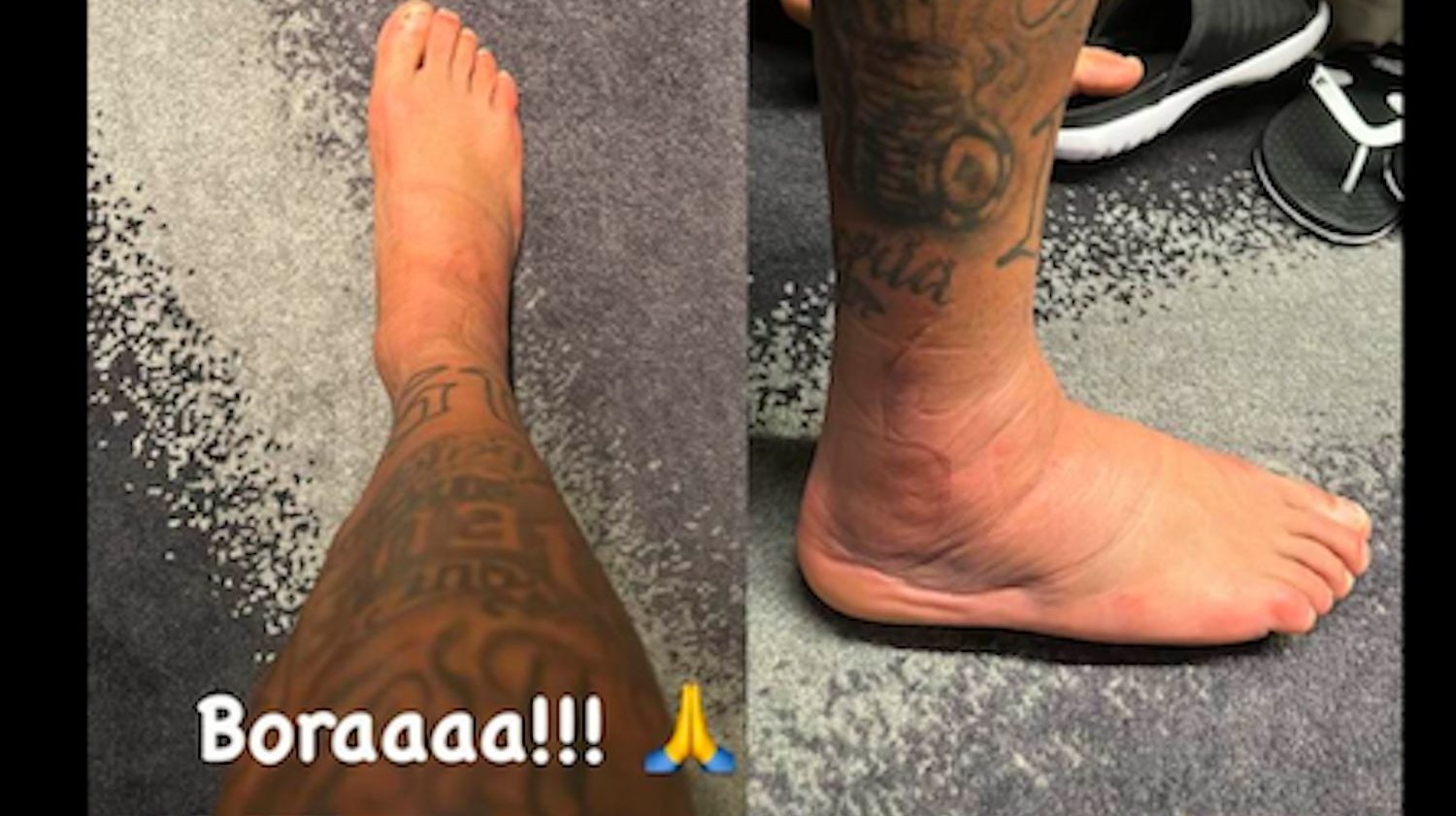 Neymar shares an image of an injured ankle that continues to worry Brazil