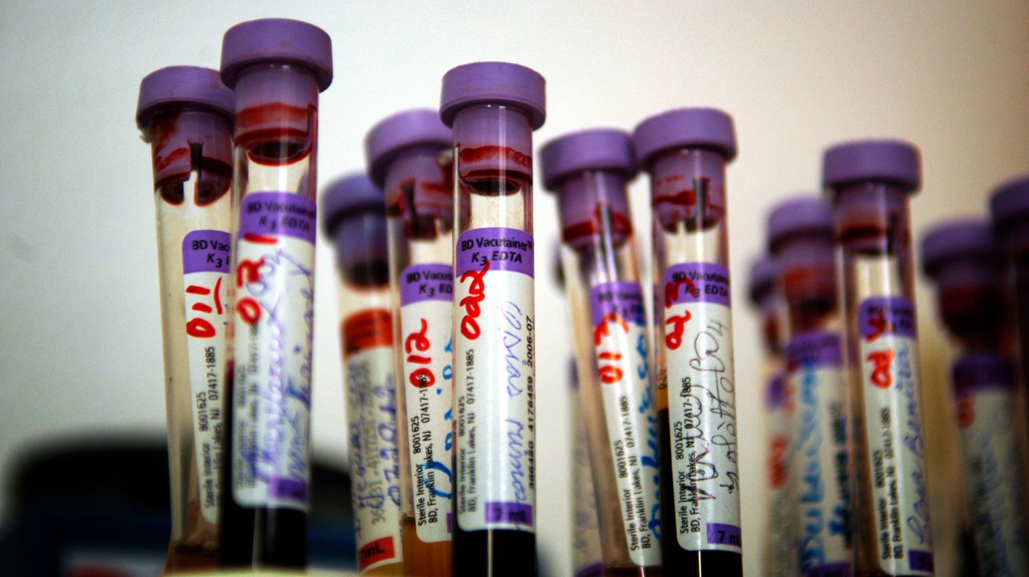 Há mais de 10 anos, em 2009, fracassaram os testes de fase 3 de uma outra vacina.