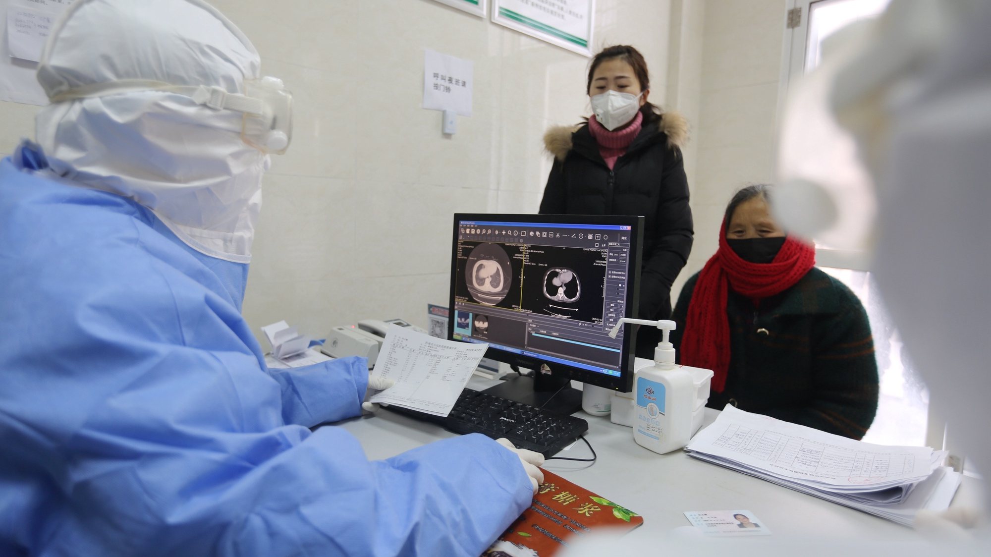 epa08212642 A doctor reads the computed tomography CT) scans of a woman&#039;s lungs in a fever clinic in Yinan County, in east China&#039;s Shandong province, 12 February 2020. The disease caused by the new coronavirus has been officially named on 11 February 2020 by the World Health Organisation (WHO) as Covid-19.  EPA/WANG YANBING CHINA OUT