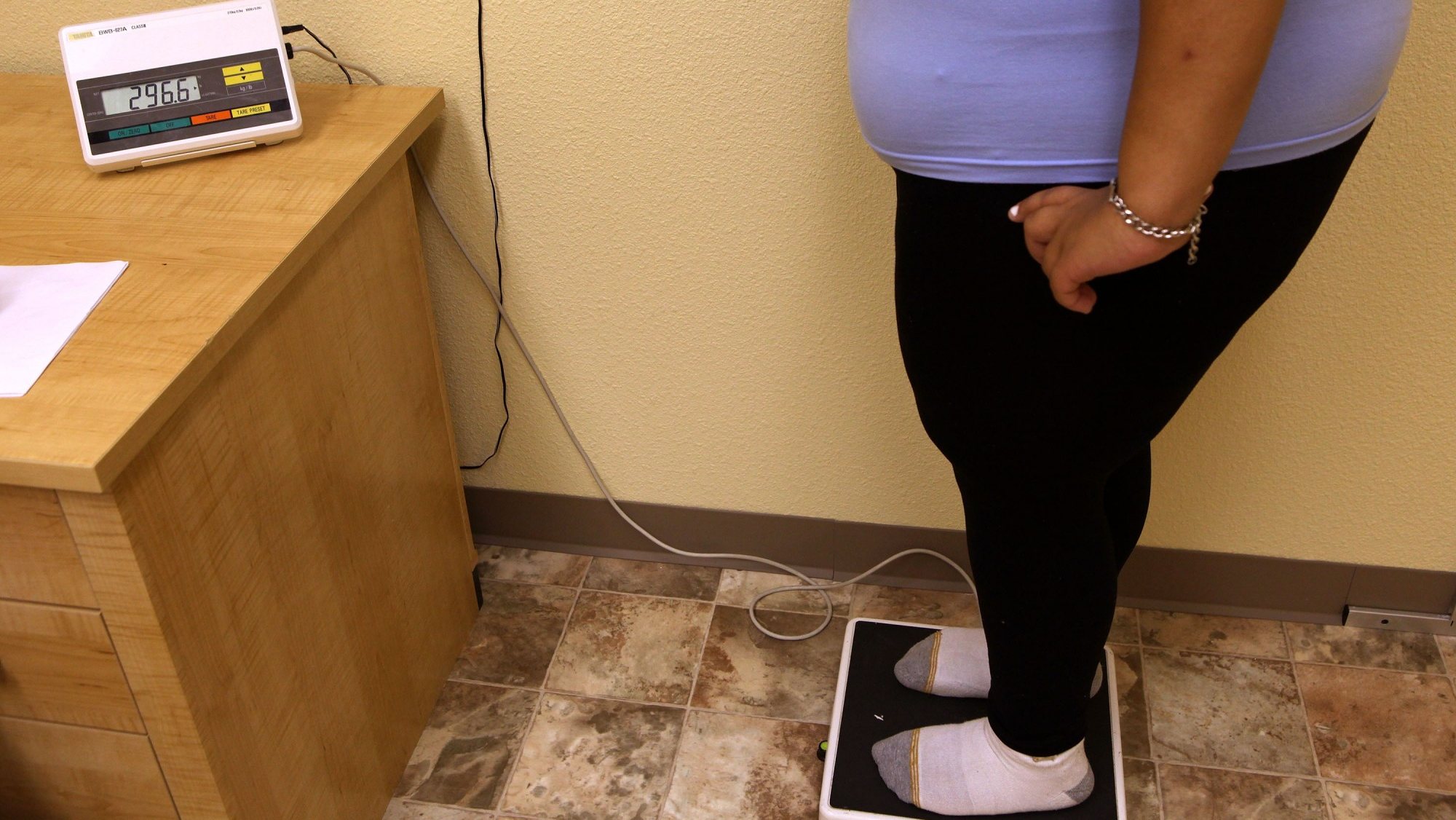 A obesidade abdominal traduz-se numa maior circunferência da cintura