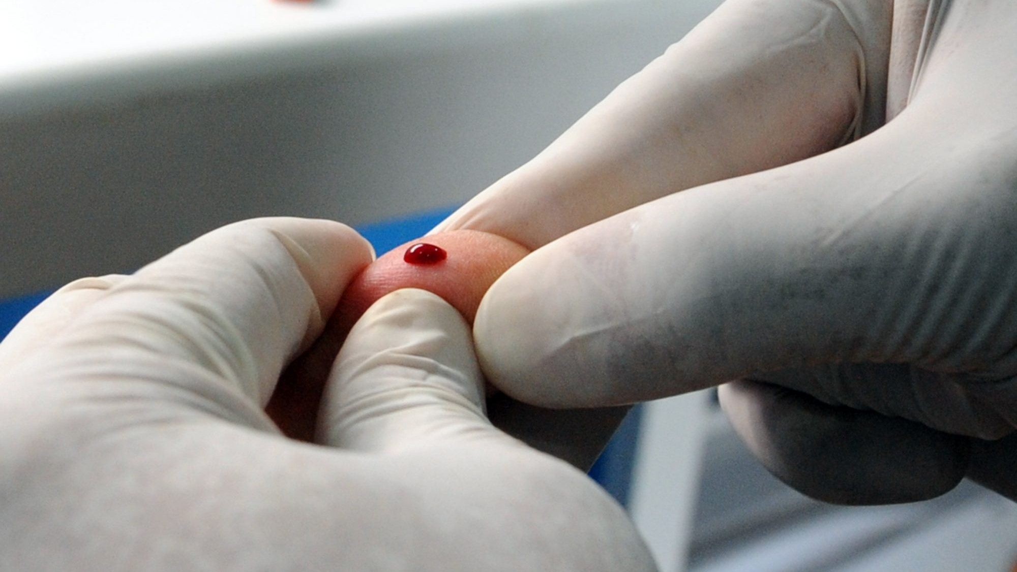 As orientações da OMS, acrescentou, servem para ajudar a fazer o diagnóstico da hepatite B, pois há agora uma nova linha de testes rápidos
