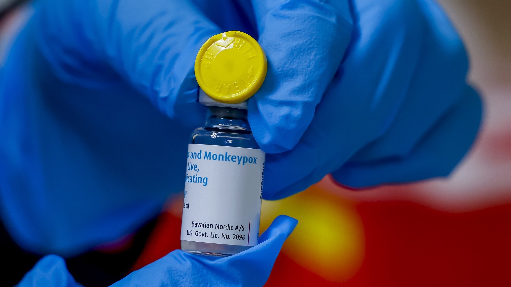 epa10107510 A nurse with the Dekalb County Board of Health holds a vial of monkeypox vaccine, at a clinic in Atlanta, Georgia, USA, 05 August 2022. The DeKalb County Board of Health, in cooperation with the Georgia Department of Public Health, was able to fill 275 appointment slots for the initial dosage of the monkeypox vaccine.  EPA/ERIK S. LESSER