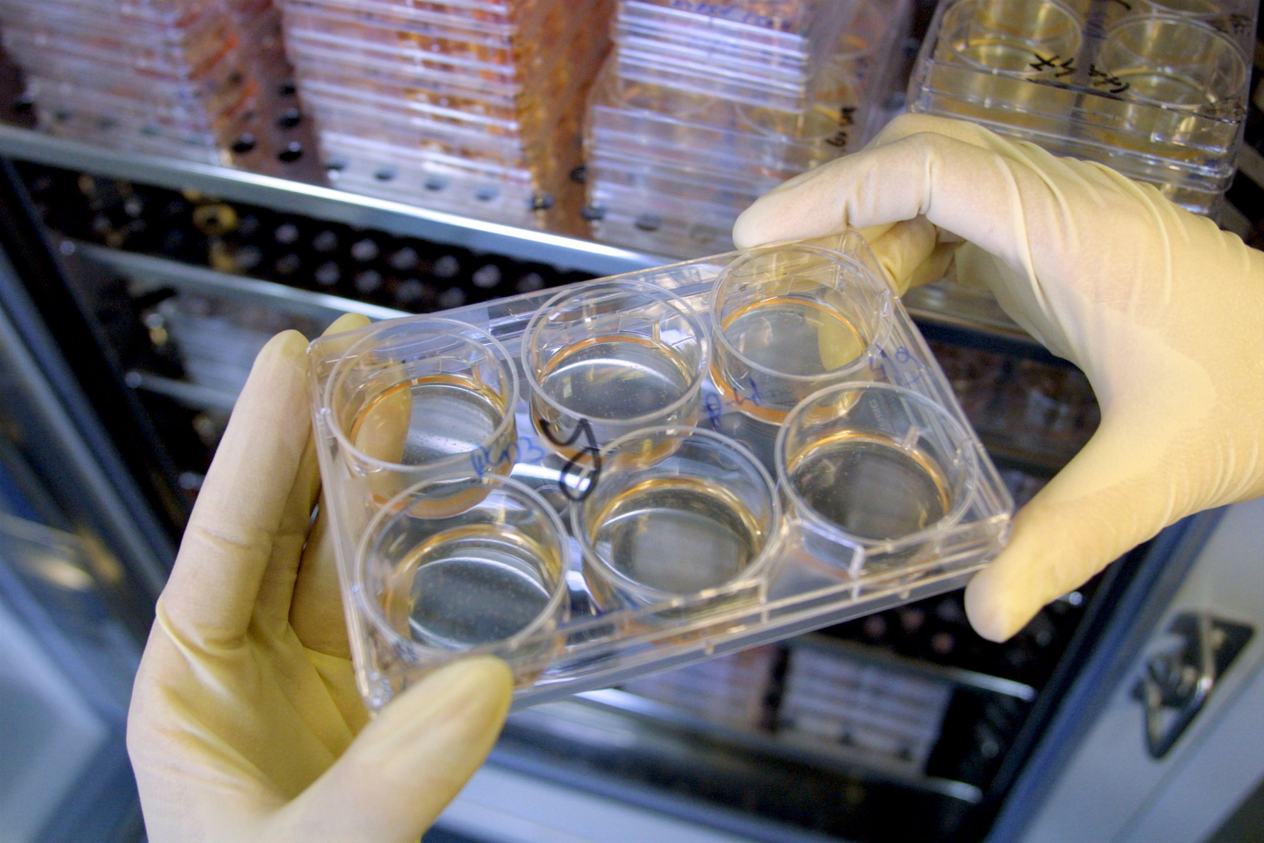 Stem Cells in Israeli Laboratory