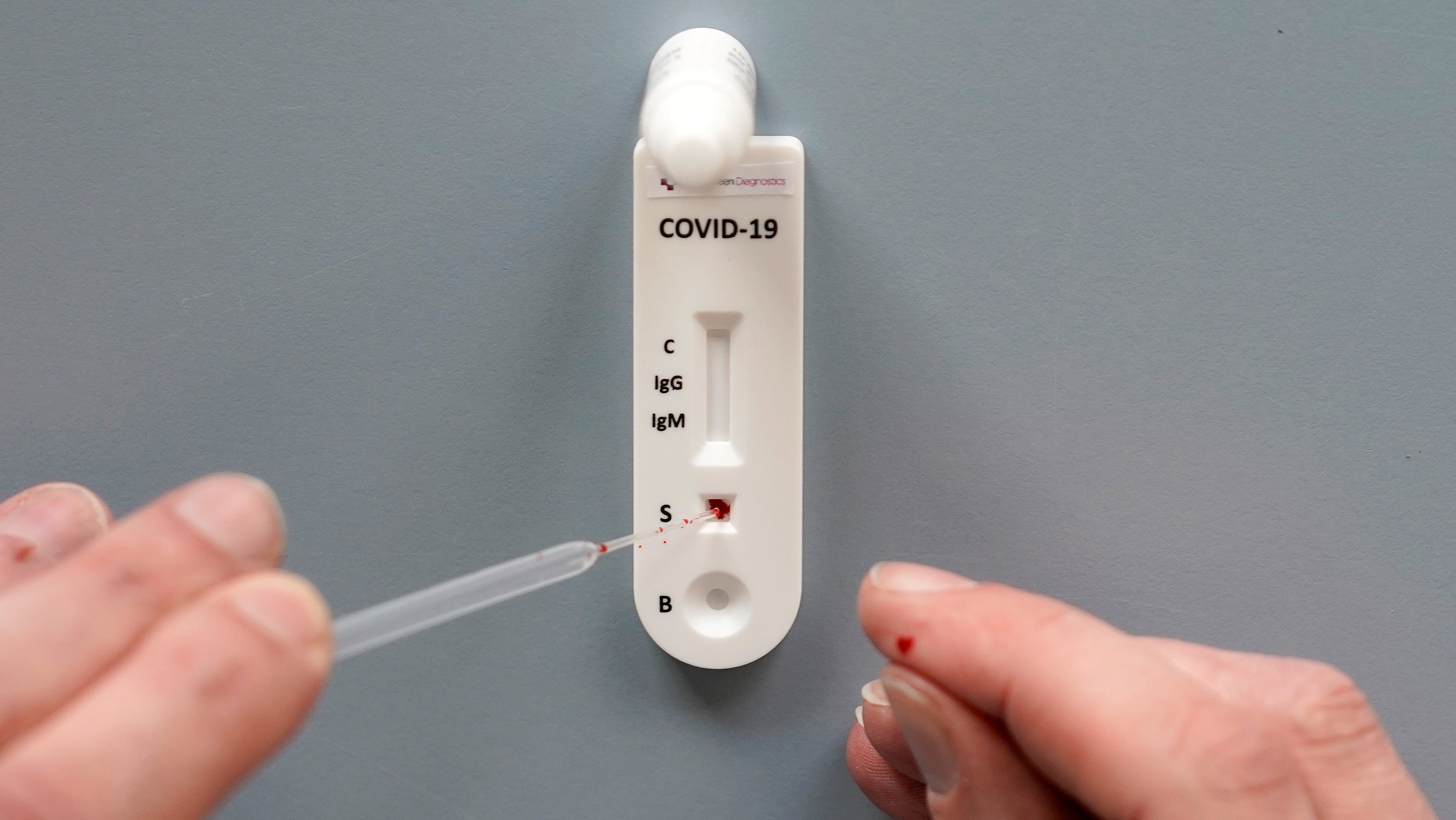 UK Company Which Produces 10 Minute Blood Test For Covid 19