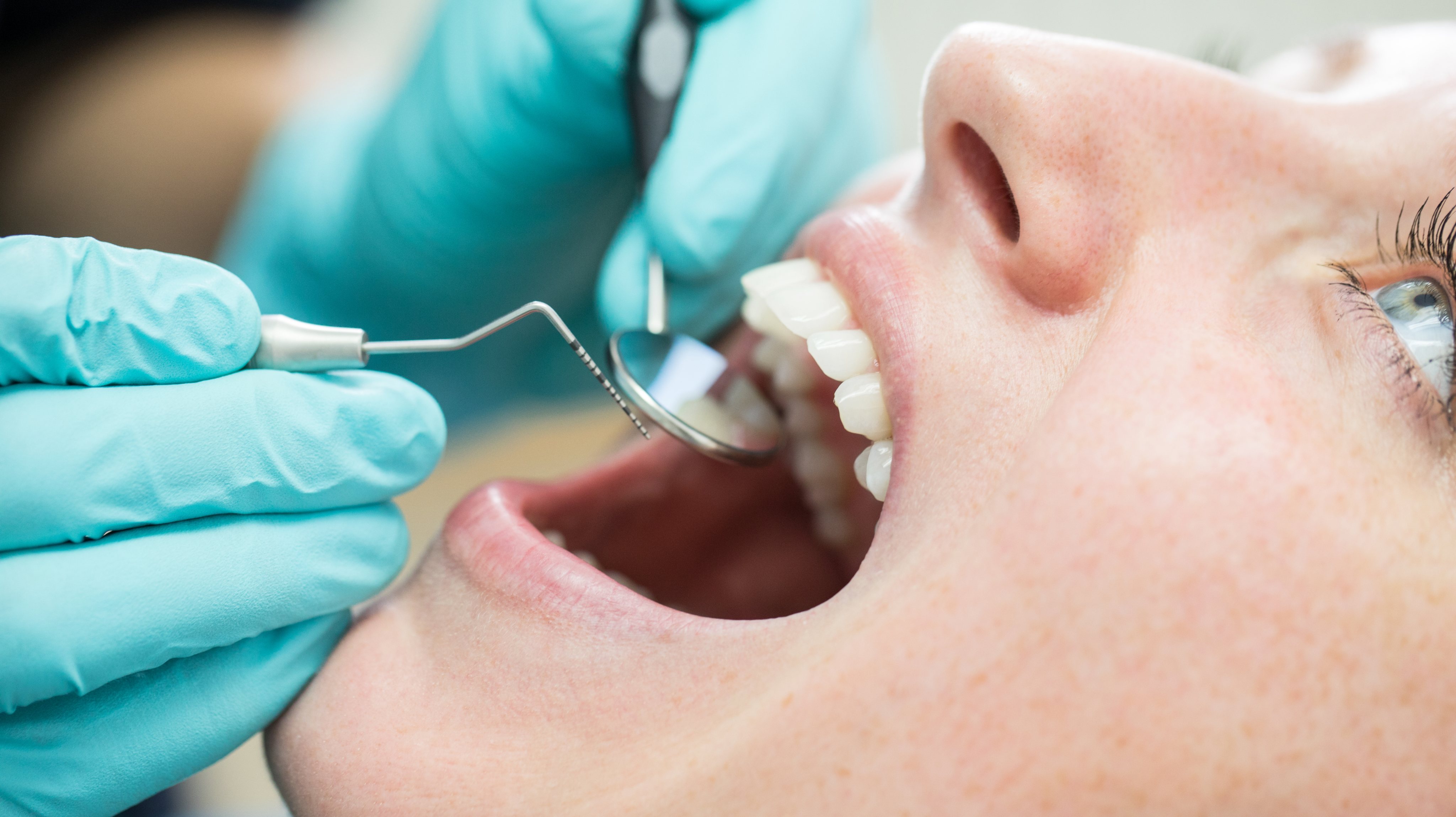 Woman getting a dental check-up at dentistry