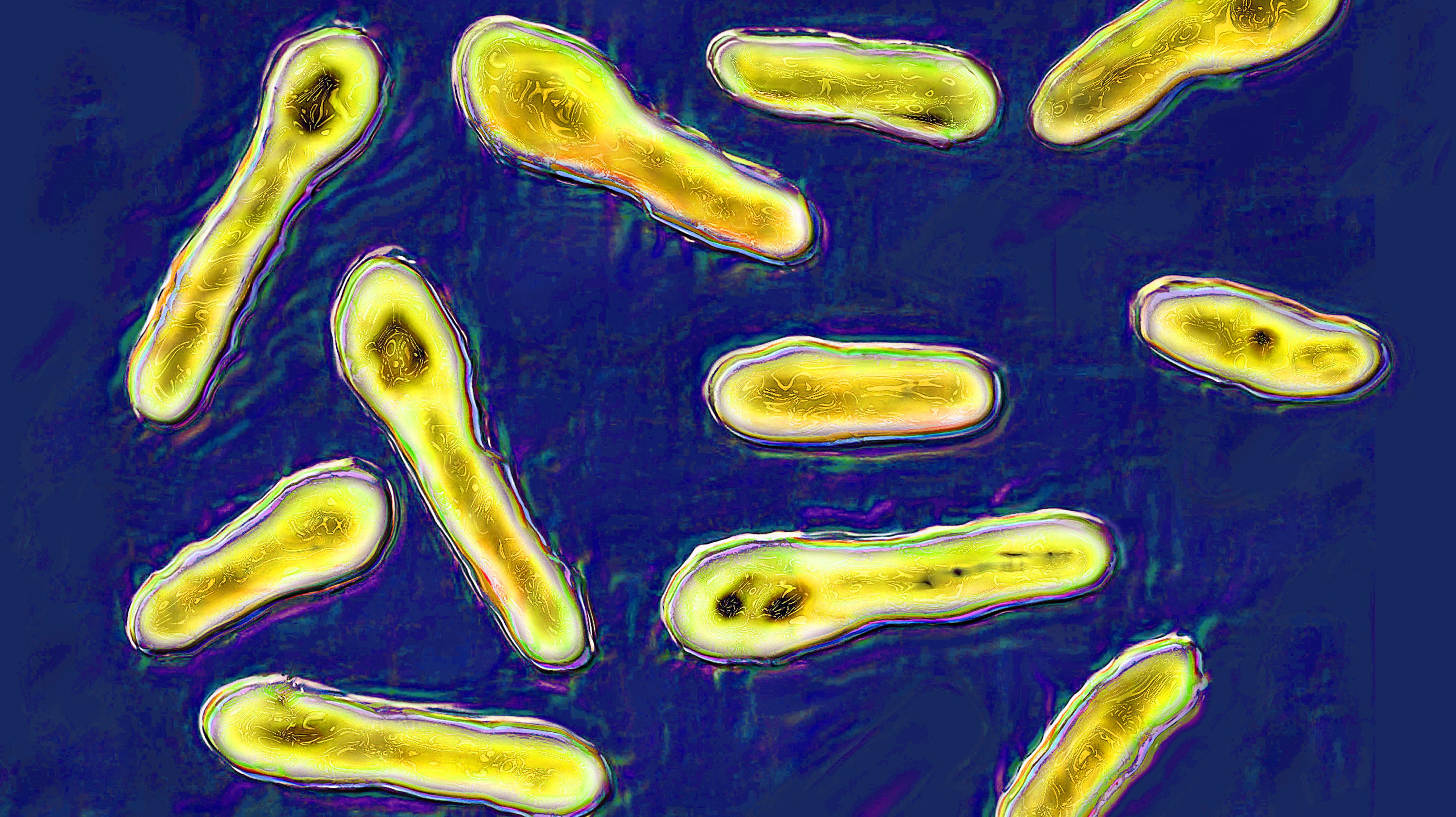 Clostridium botulinum or botulinum bacillus is a bacterium that secretes botox, a toxin that inhibits the neurons responsible for muscle contraction. By localized injection, the toxin reduces wrinkles by paralyzing the muscles causing wrinkles. Colorization and HDRI treatments on X 1000 optical microscopy. (Photo by: CAVALLINI JAMES/BSIP/Universal Images Group via Getty Images)