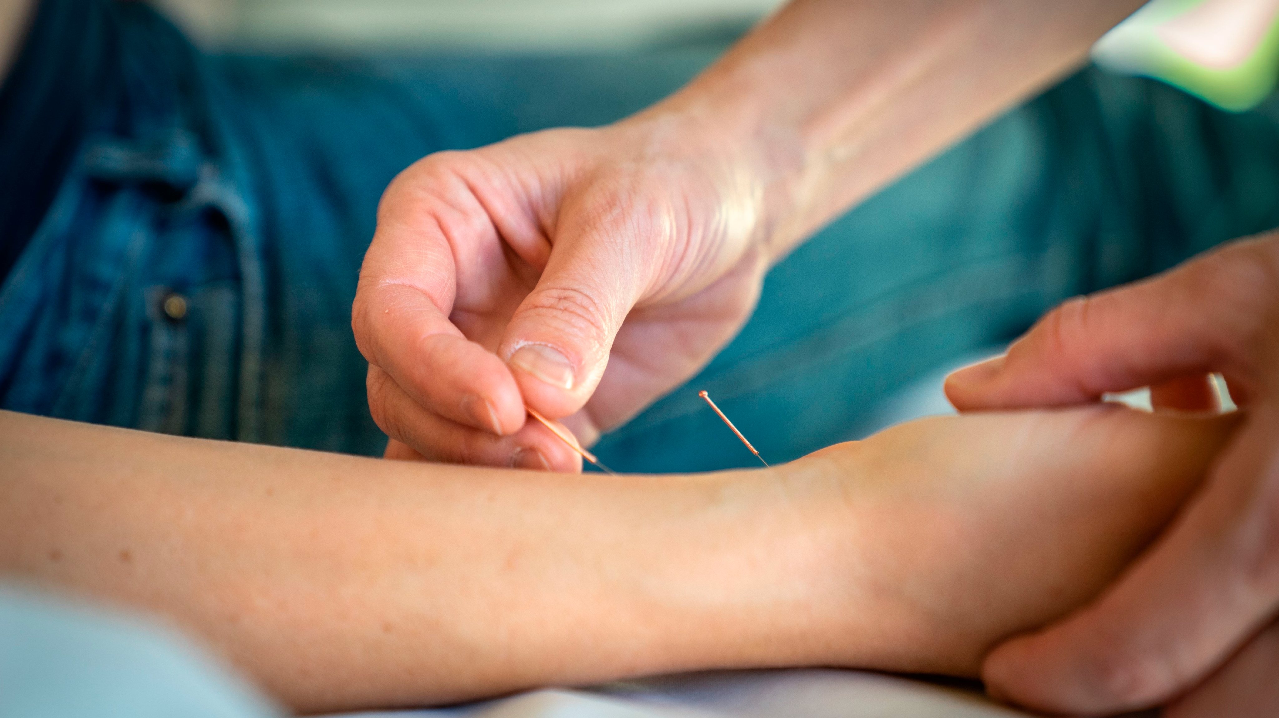 Acupuncture for Pregnant woman