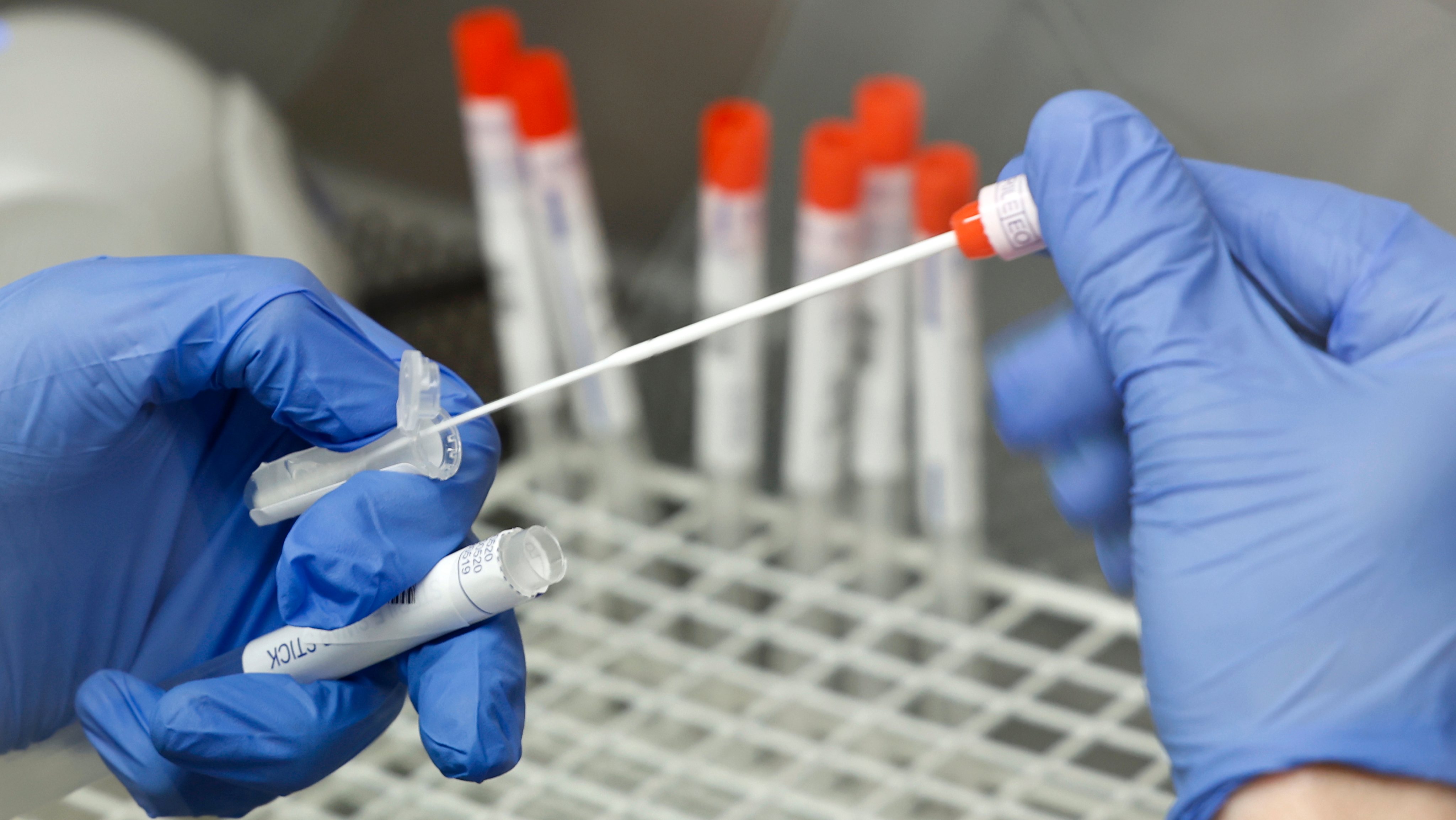 Teste PCR para o coronavírus
