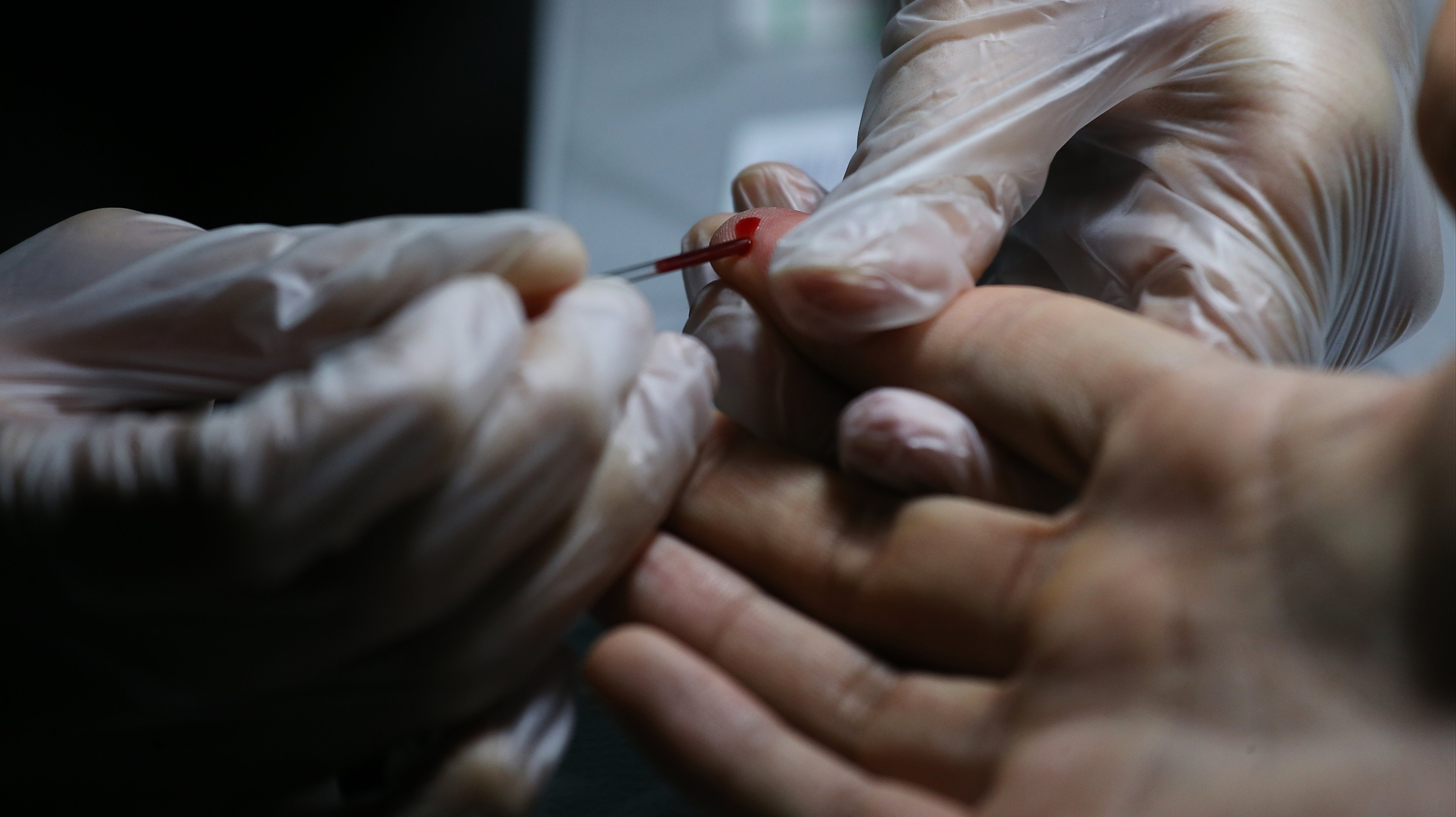 Finger-prick blood is needed for an HIV rapid test, which gives a result in 20 minutes at AIDS Concerns Centre, Jordan. 30NOV17 SCMP / Dickson Lee